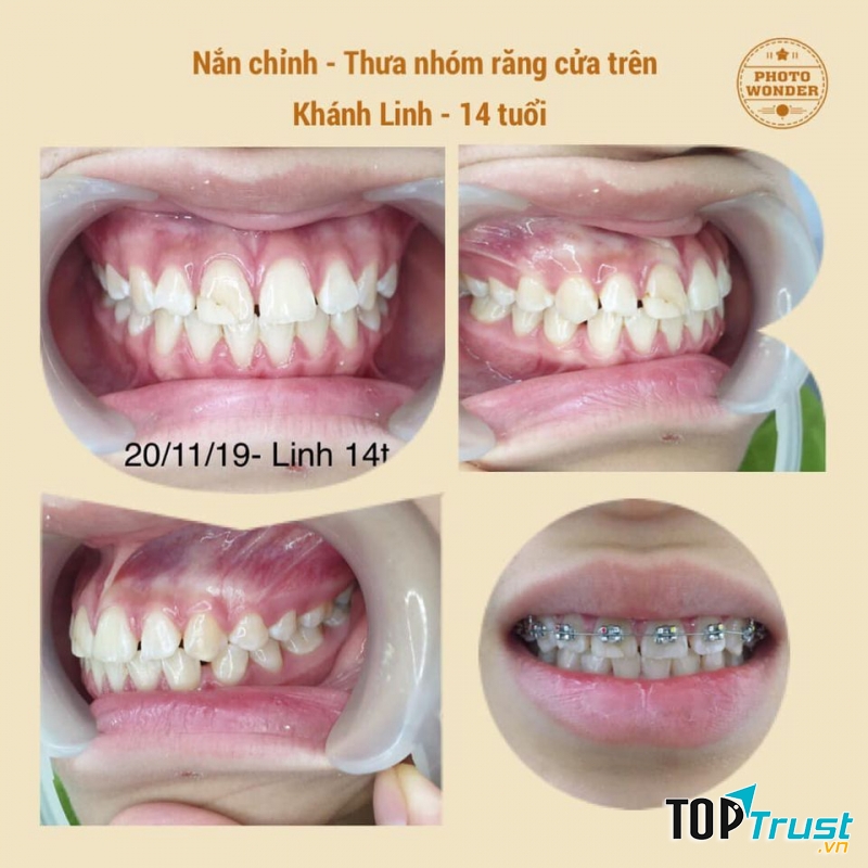 Nha khoa Sài Gòn Hải Phòng