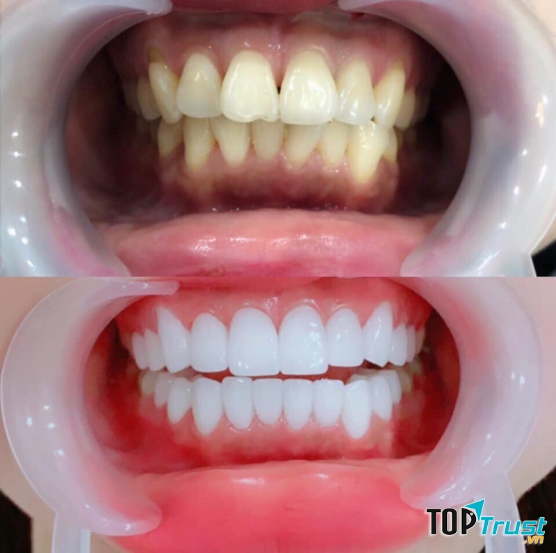 Nha Khoa Sài Gòn Quốc Tế