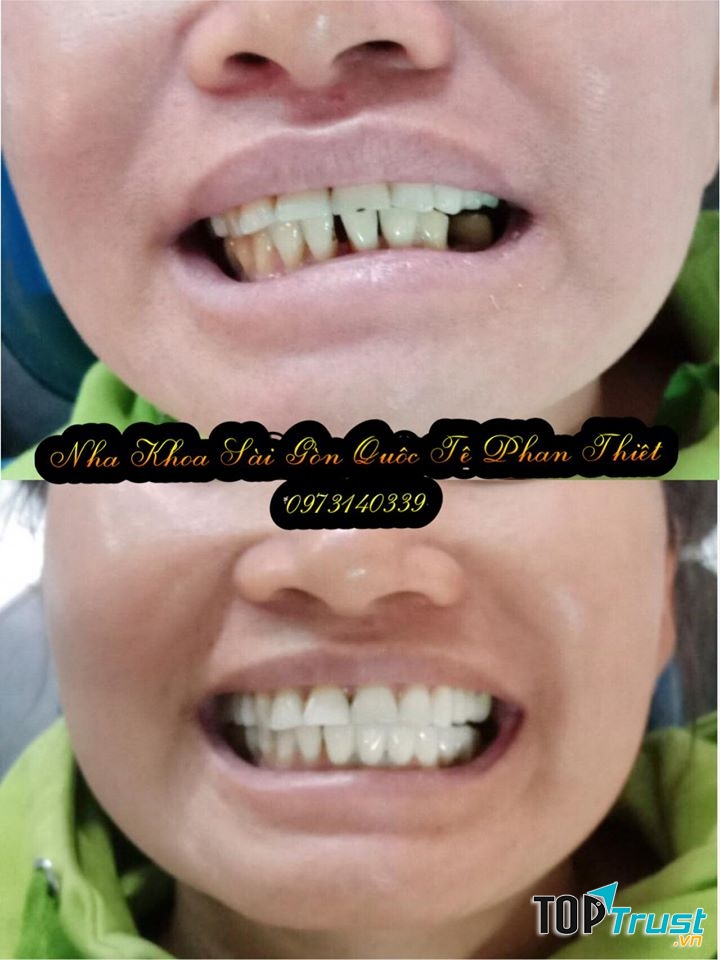 Nha Khoa Sài Gòn Quốc Tế