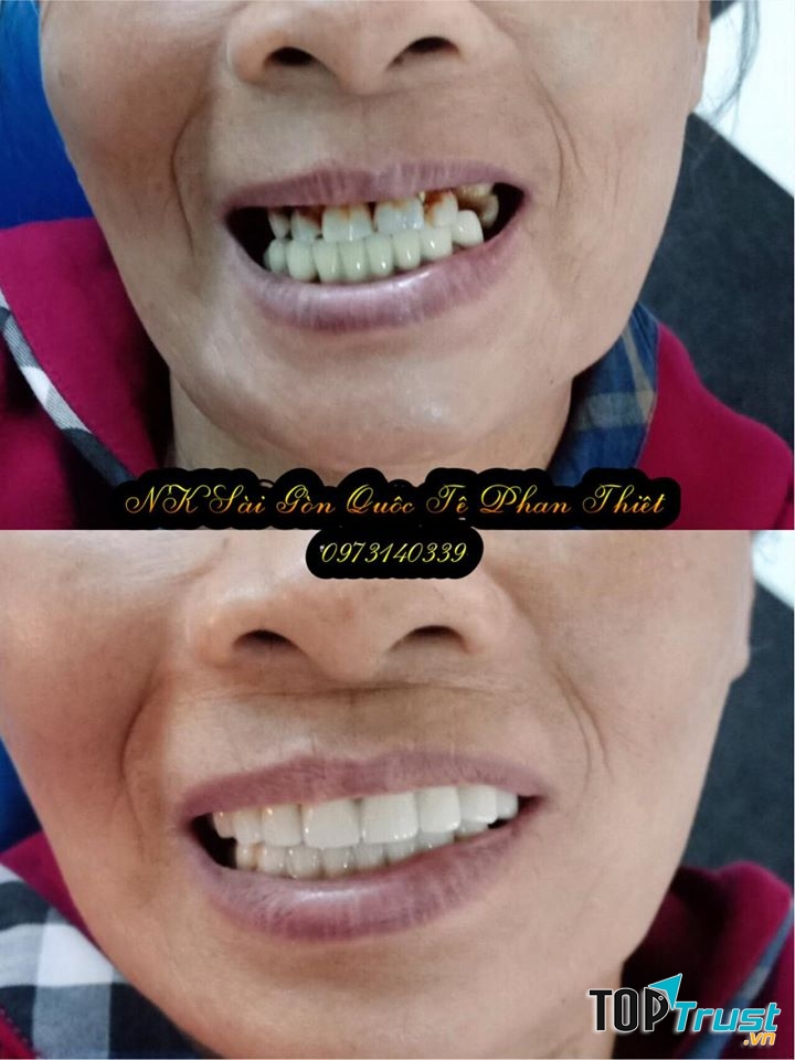 Nha Khoa Sài Gòn Quốc Tế