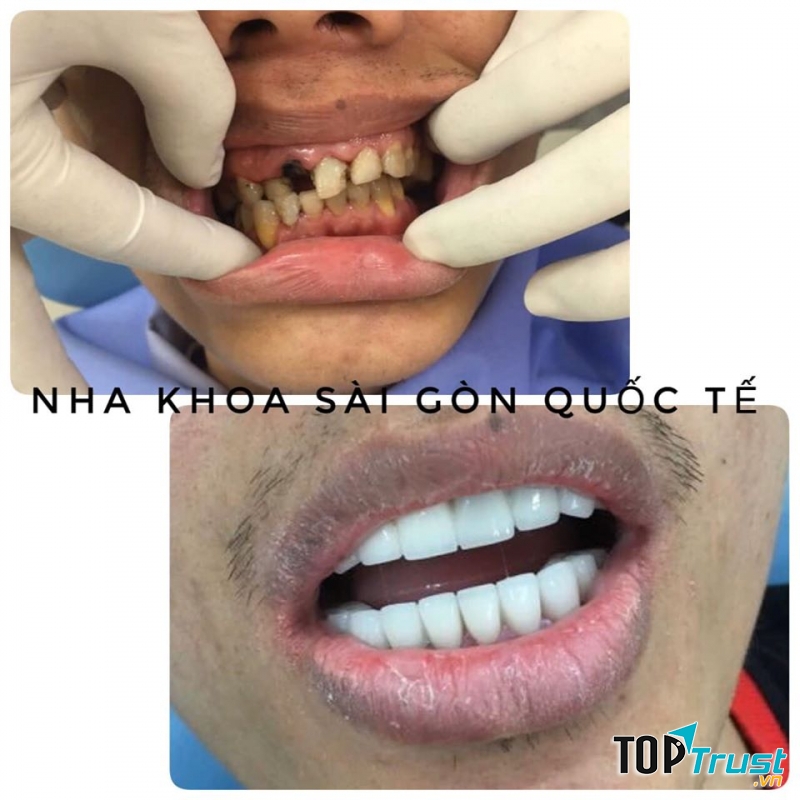 Nha khoa Sài Gòn Quốc tế