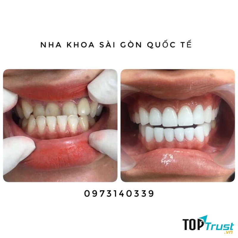 Nha khoa Sài Gòn Quốc tế
