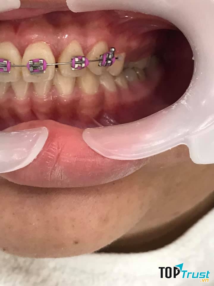 Nha Khoa Sài Gòn Smile