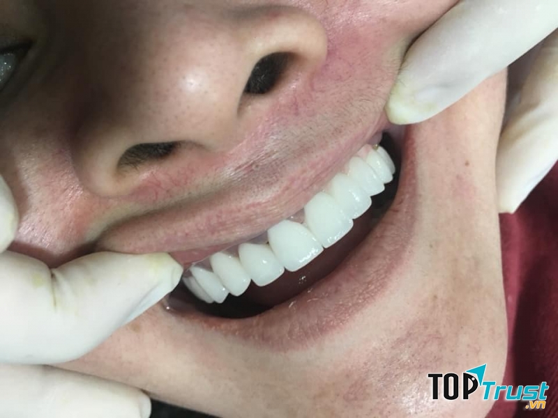 Nha Khoa Sài Gòn-Tam Kỳ