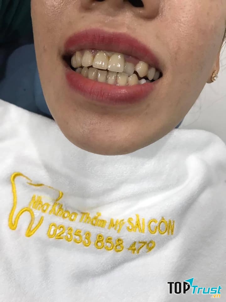 Nha Khoa Sài Gòn-Tam Kỳ