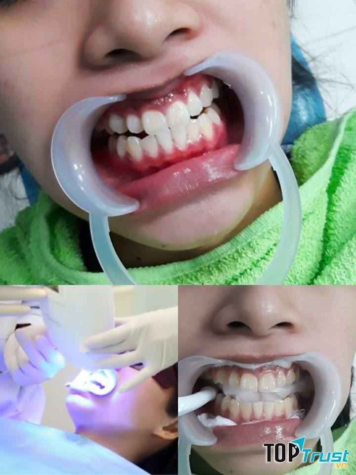 Nha khoa Sài Gòn Trảng Bàng