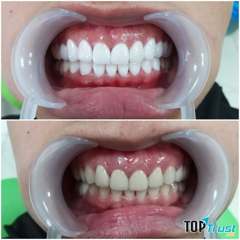 Nha khoa Sài Gòn Trảng Bàng