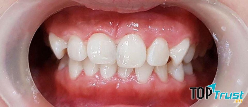 Nha Khoa Sài Gòn Việt Mỹ