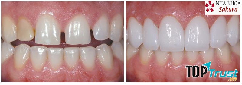 Nha Khoa SAKURA