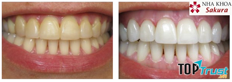 Nha Khoa SAKURA
