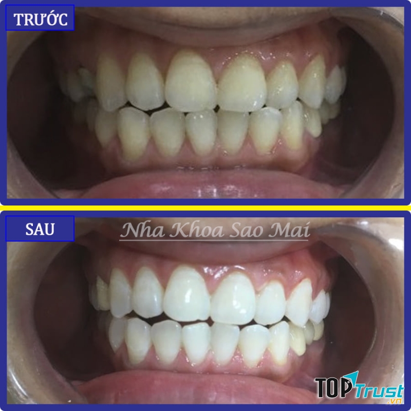 Nha Khoa SAO MAI - Dental Clinic