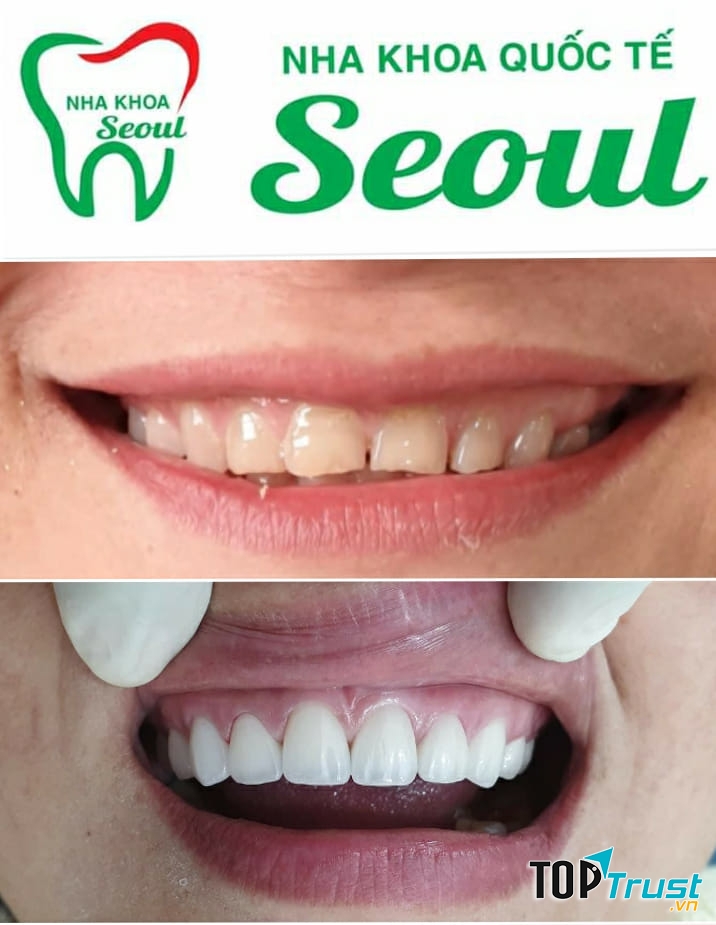 Nha khoa Seoul