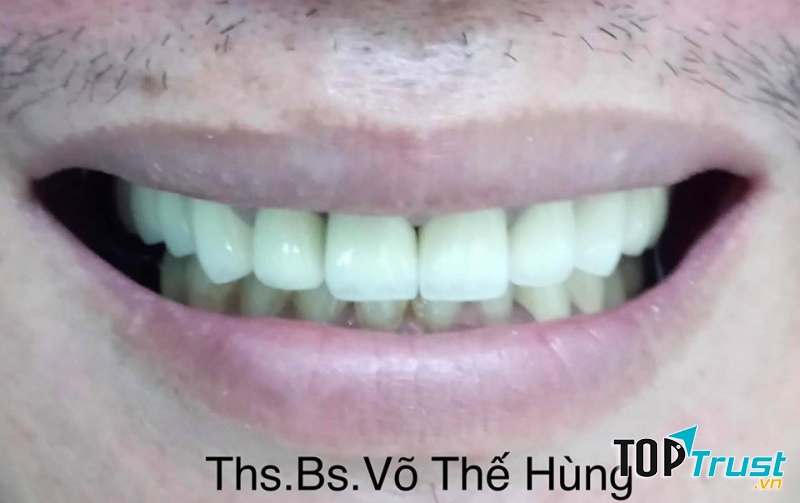 Nha Khoa Smile Tam Kỳ