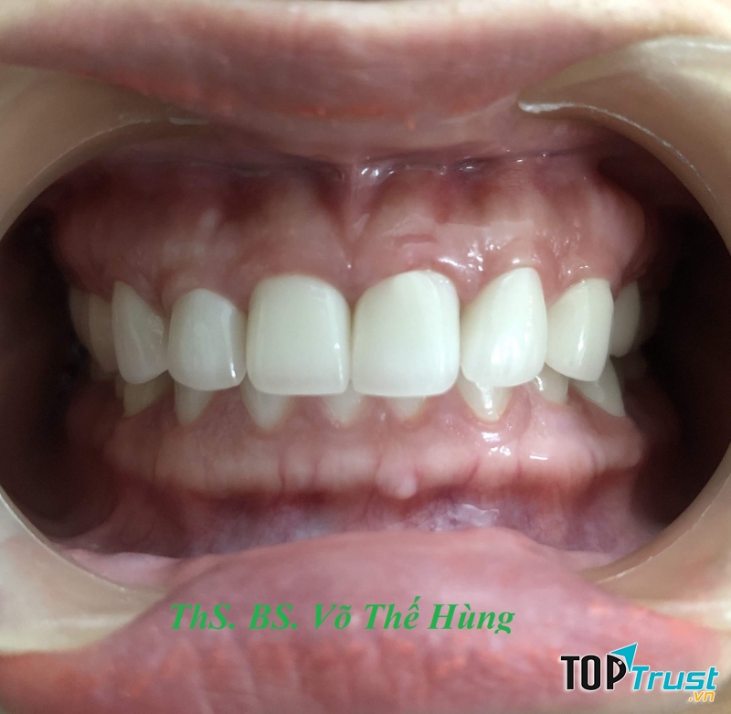 Nha Khoa Smile Tam Kỳ