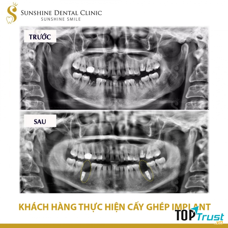 Nha Khoa Sunshine Dental Clinic