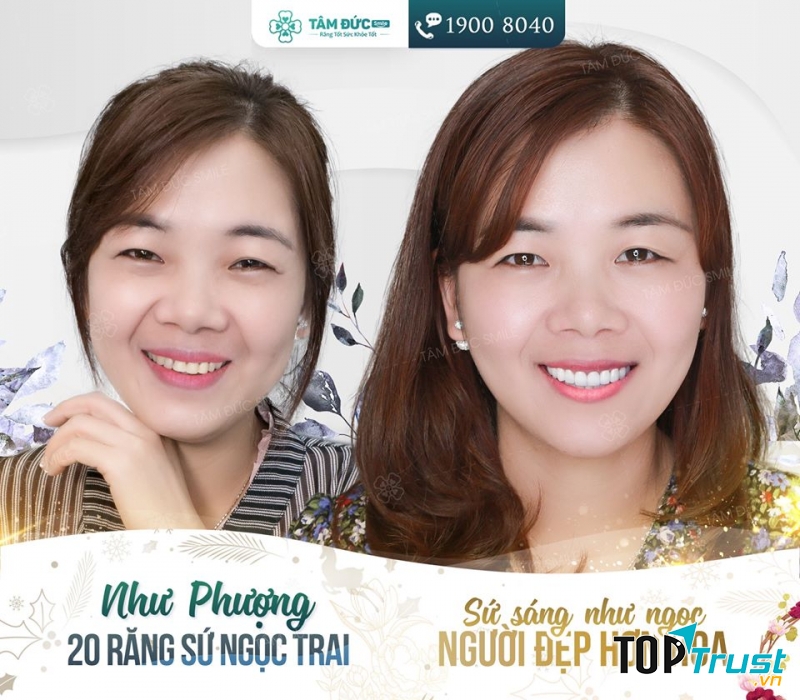 Nha khoa Tâm Đức Smile