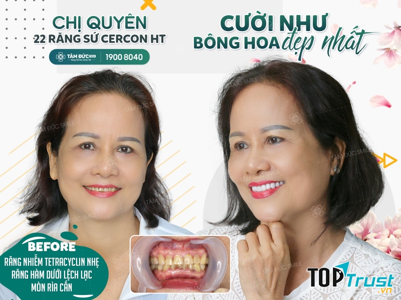 Trung tâm Nha khoa Tâm Đức Smile