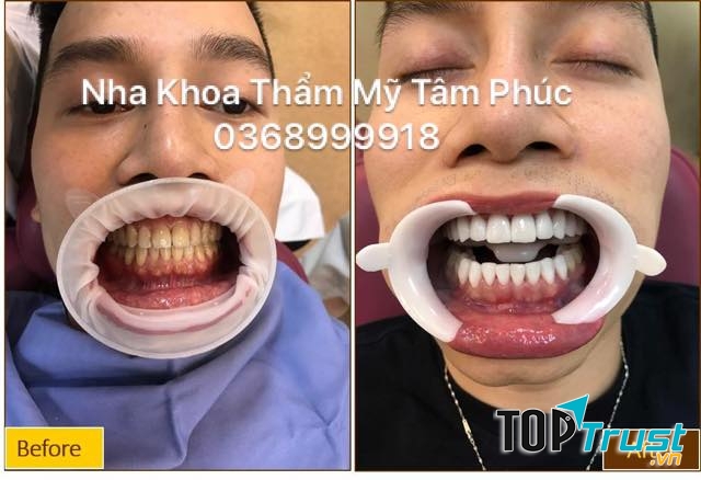 Nha Khoa Thẩm Mĩ Tâm Phúc