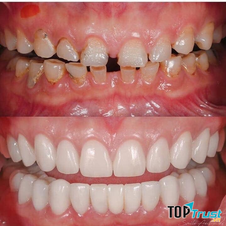 Nha Khoa thẩm mỹ Á Châu