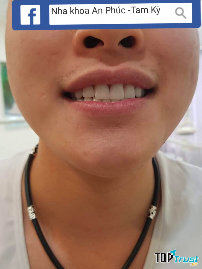 Nha Khoa Thẩm Mỹ An Phúc