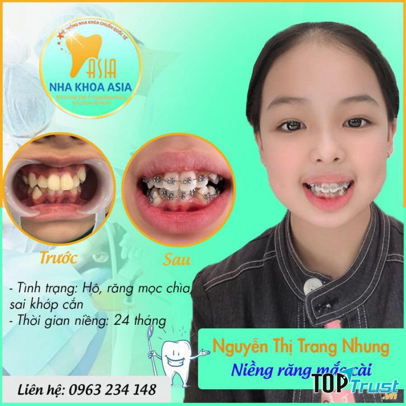 Nha khoa Thẩm mỹ Asia