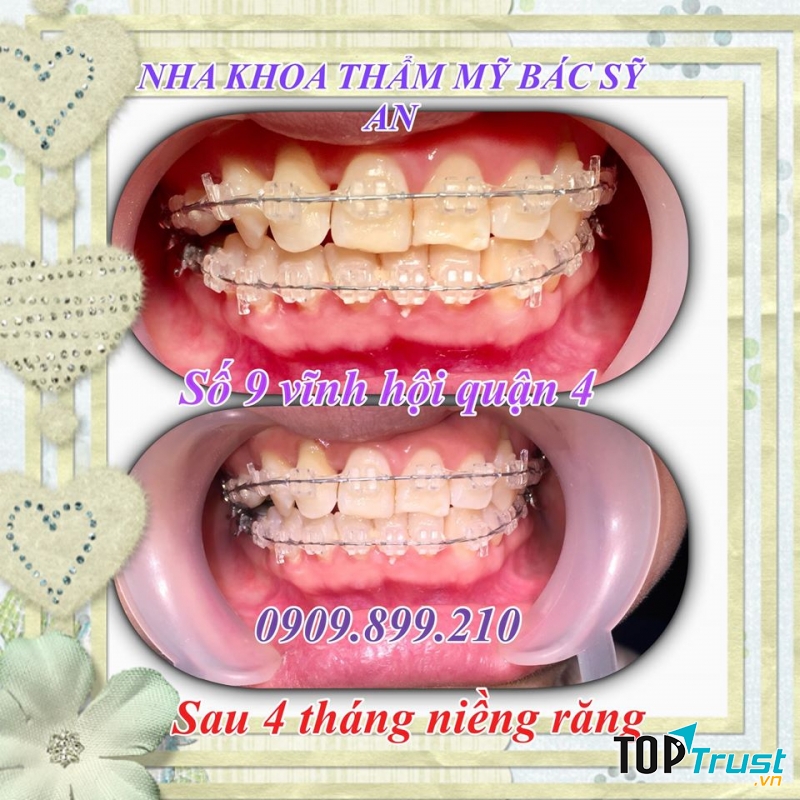 Nha khoa thẩm mỹ bác sĩ An