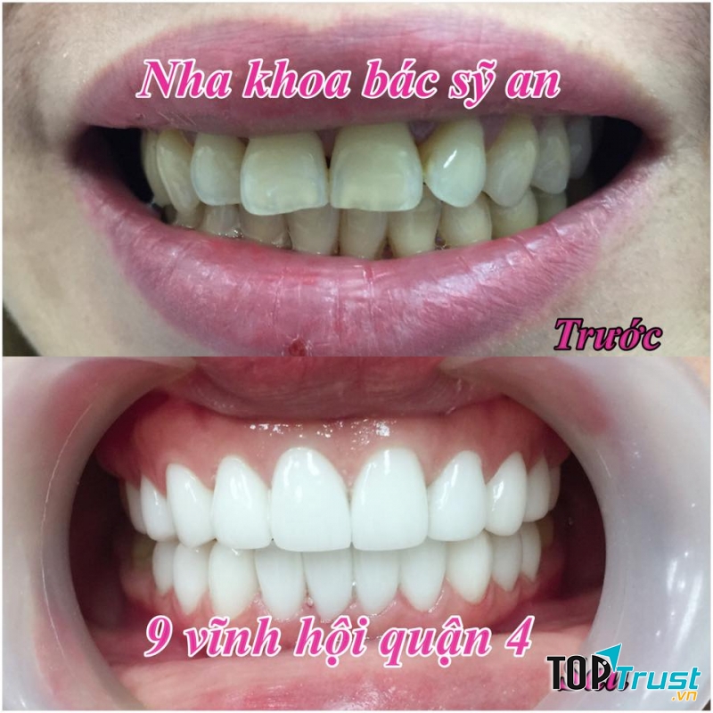 Nha Khoa  Thẩm Mỹ Bác Sĩ An