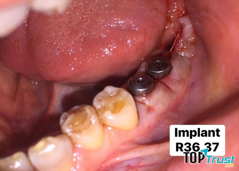 Nha khoa thẩm mỹ Hà Nội