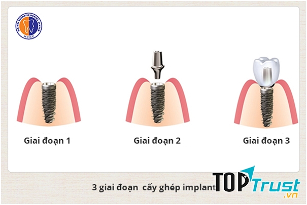 Nha khoa thẩm mỹ Hà Nội