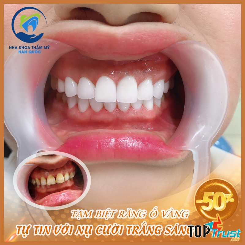 Nha Khoa Thẩm Mỹ Hàn Quốc Hà Tĩnh