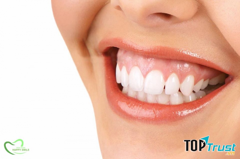 Nha khoa thẩm mỹ HAPPY SMILE