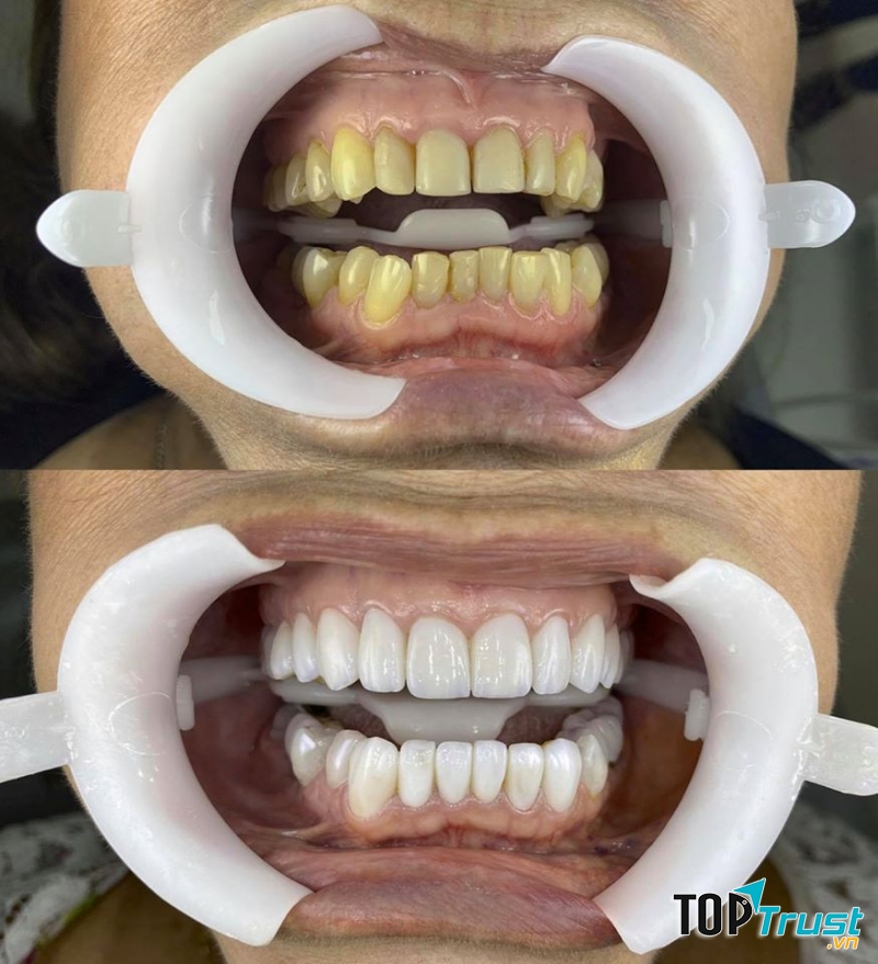 Nha Khoa Thẩm Mỹ Lào Cai - Ann Dental