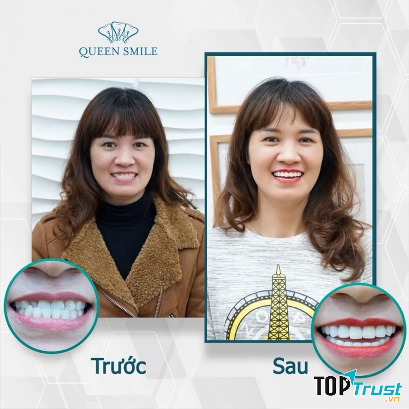 Nha khoa thẩm mỹ Queen Smile