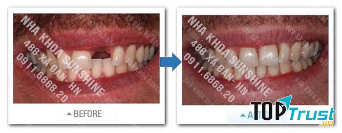 Nha khoa thẩm mỹ Sunshine