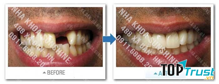 Nha khoa thẩm mỹ Sunshine