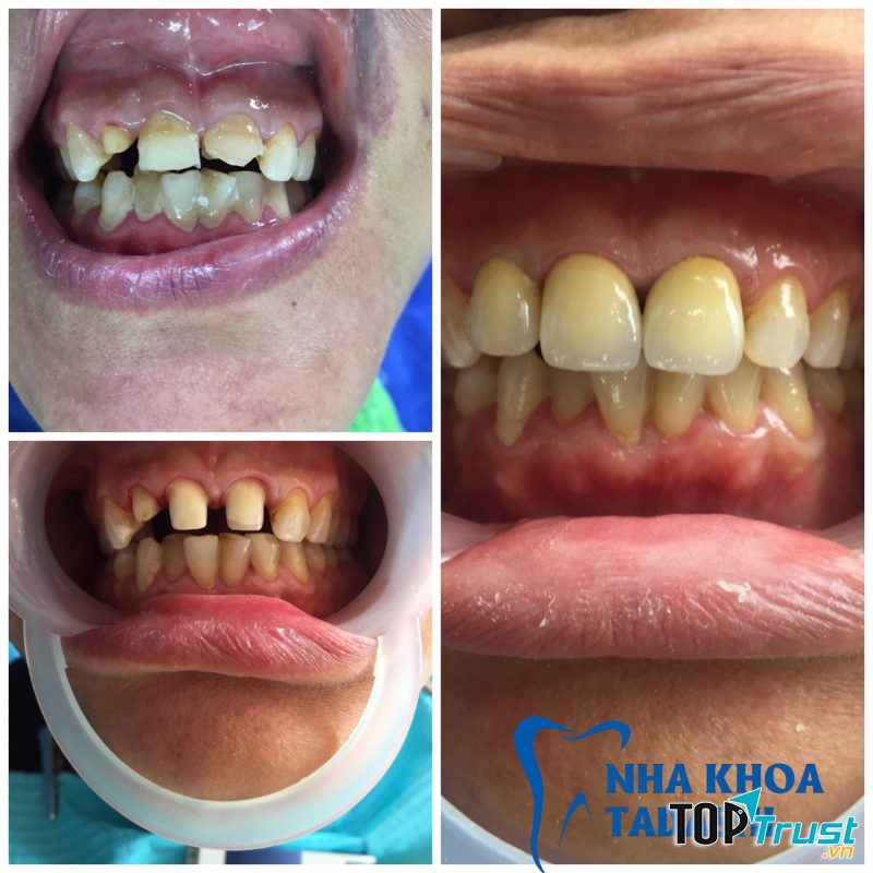 Nha khoa thẩm mỹ Tadashi Thanh Hóa