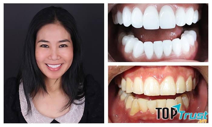 Nha Khoa Thẩm Mỹ Thanh Tú