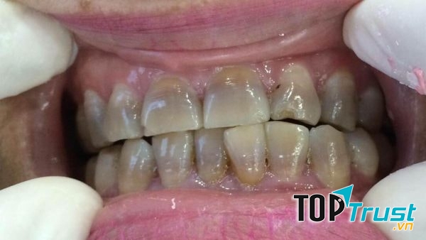 Nha Khoa Thẩm Mỹ Thanh Tú