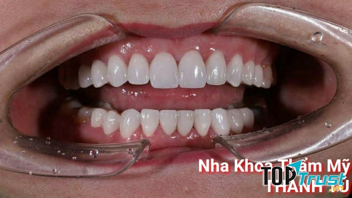 Nha Khoa Thẩm Mỹ Thanh Tú