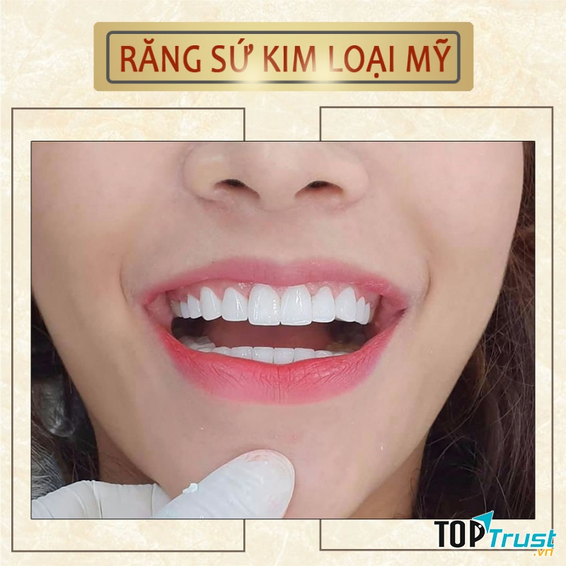 Nha Khoa Thăng Long International