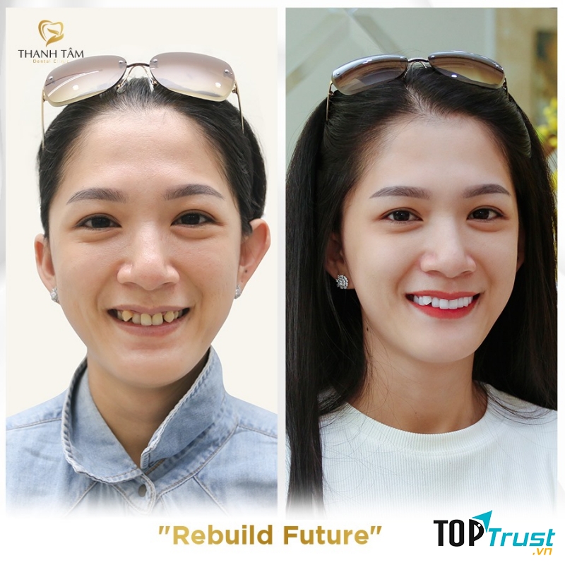 Nha Khoa Thanh Tâm - Chi nhánh Cần Thơ