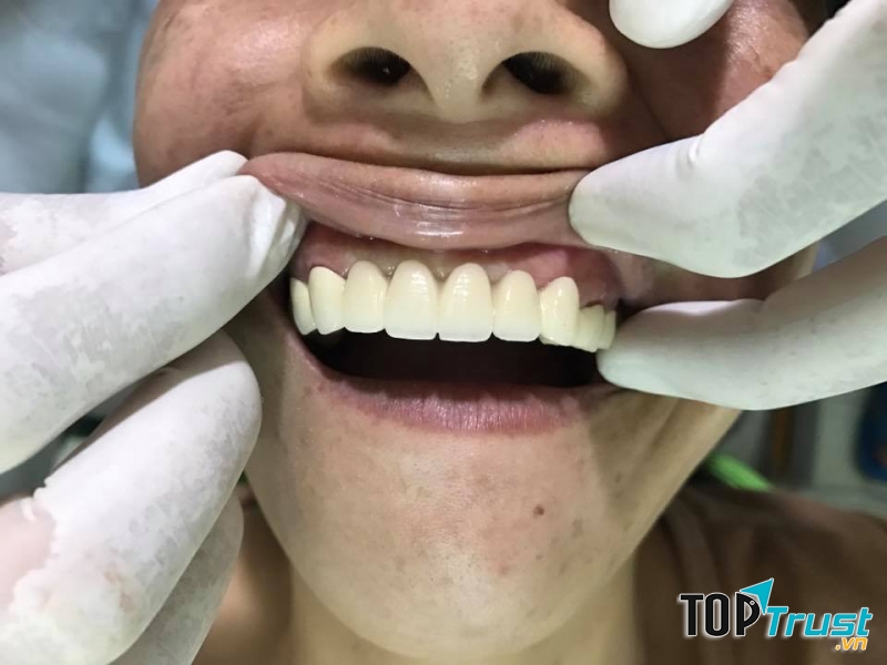 Nha Khoa Thiện Mỹ