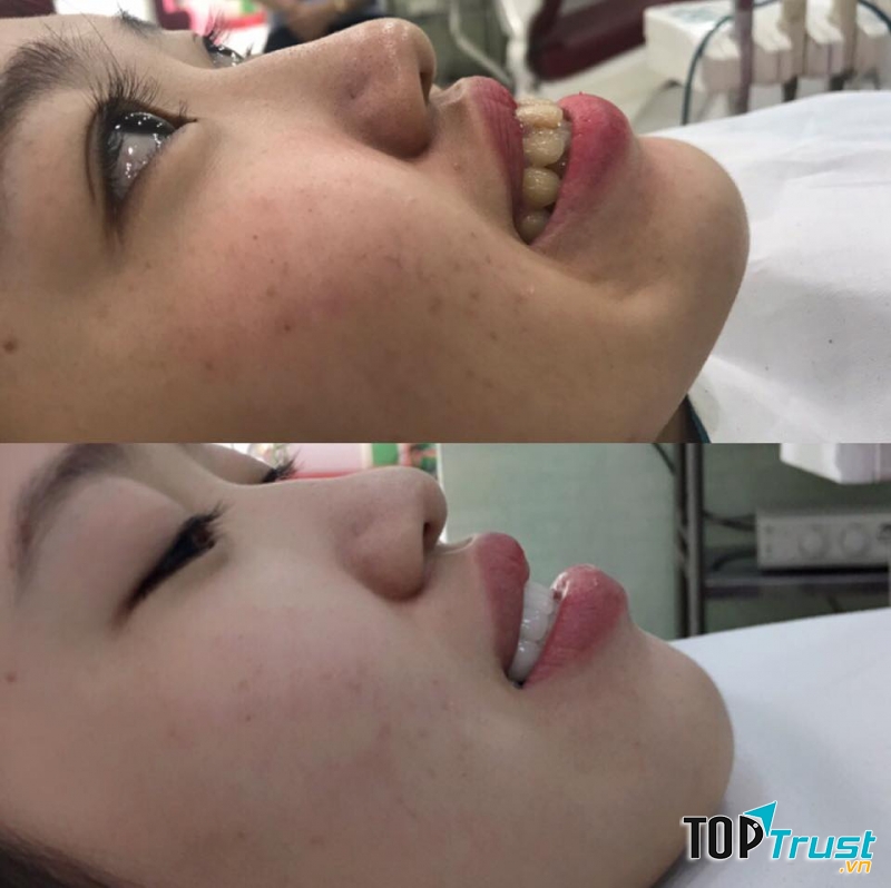 Nha khoa Toàn Ý