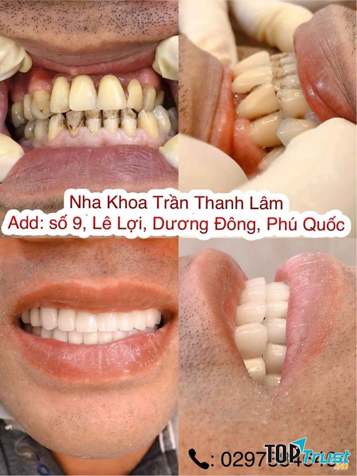 Nha Khoa Trần Thanh Lâm