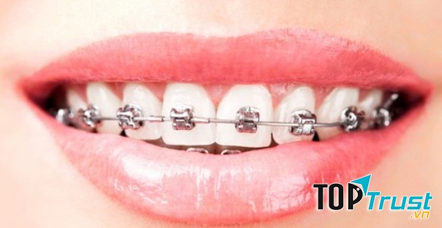 Nha khoa Trường Sơn