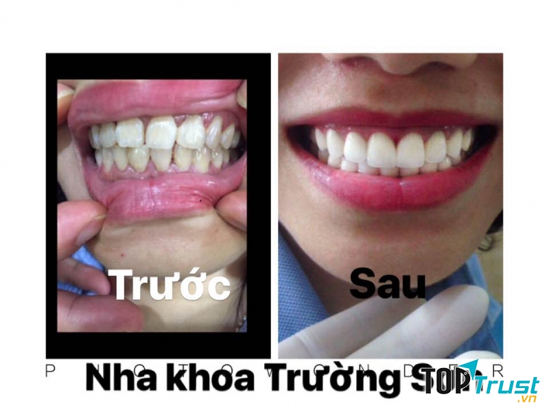 Nha Khoa Trường Sơn