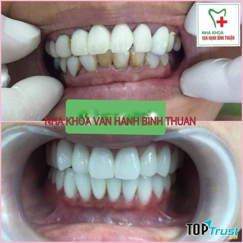 Nha khoa Vạn Hạnh Bình Thuận