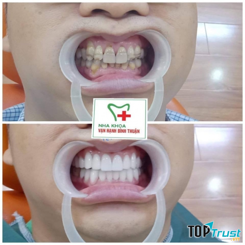 Nha khoa Vạn Hạnh Bình Thuận