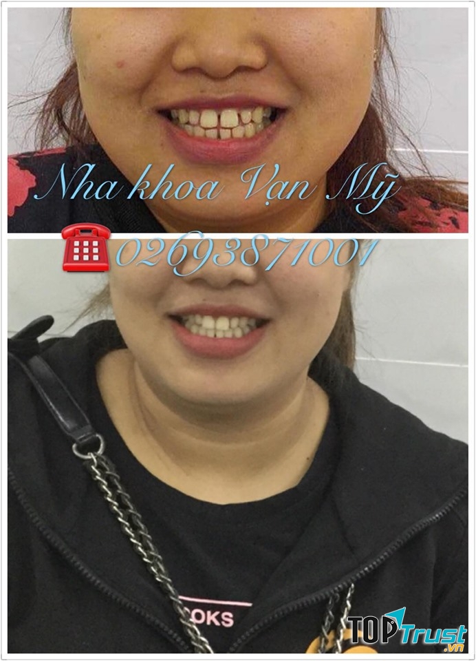 Nha Khoa VẠN MỸ - Gia Lai
