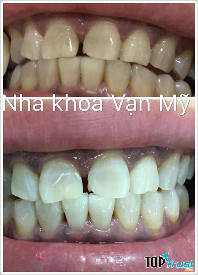 Nha Khoa VẠN MỸ - Gia Lai